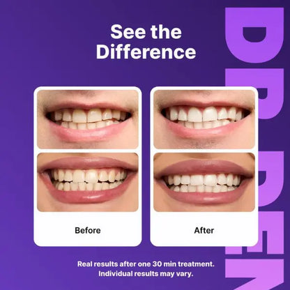 Dr Dent Purple Teeth Whitening Strips